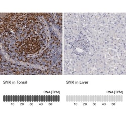SYK Antibody, Novus Biologicals:Antibodies:Primary Antibodies